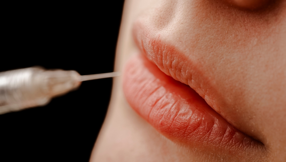 Your Guide to Mini Lip Filler Prices Near Timonium, MD for Subtle, Natural Volume and Definition