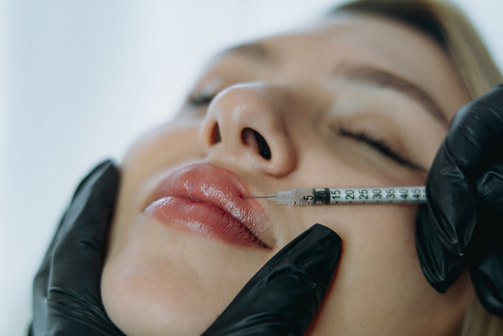 Walk In, Walk Out With the Perfect Pout: Your Guide to a Same-Day Lip Filler Appointment Near Timonium, MD