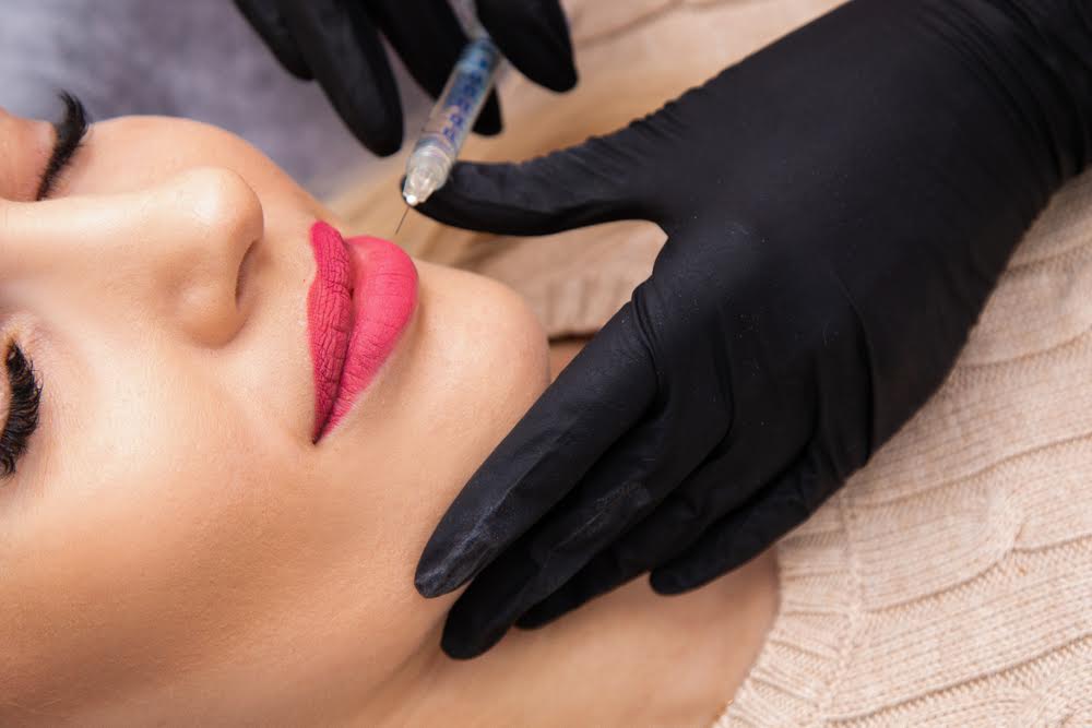 Best Lip Filler Pricing in Bel Air, MD: What to Expect Before Your Appointment