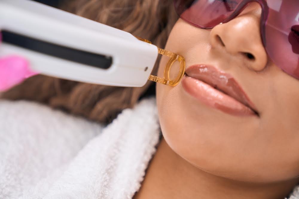 How Much Does Full Face Laser Hair Removal Cost in Bel Air, MD?