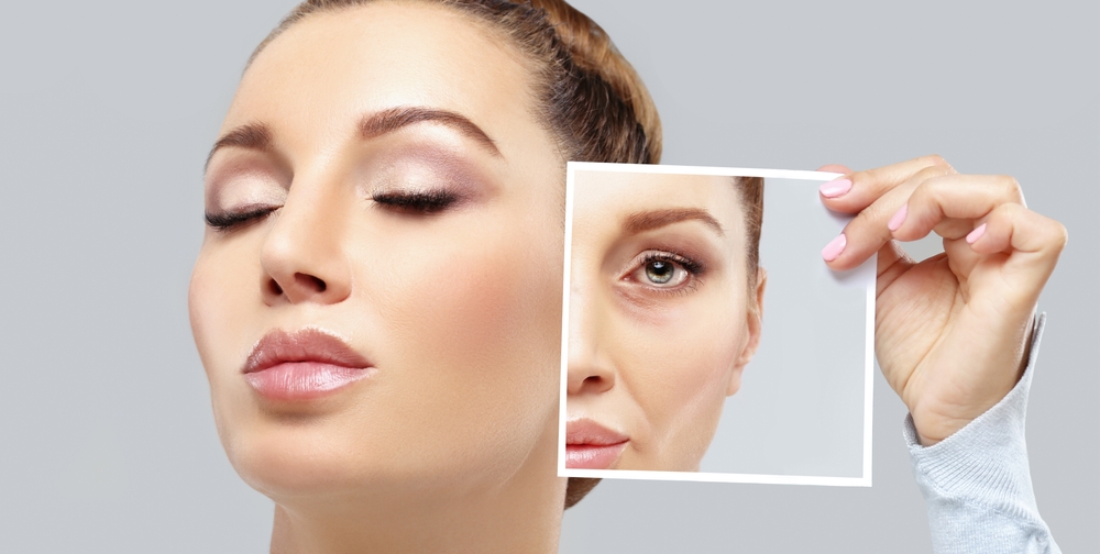 Top Under-Eye Filler Options Near Lutherville, MD for Dark Circles and Hollow Eyes