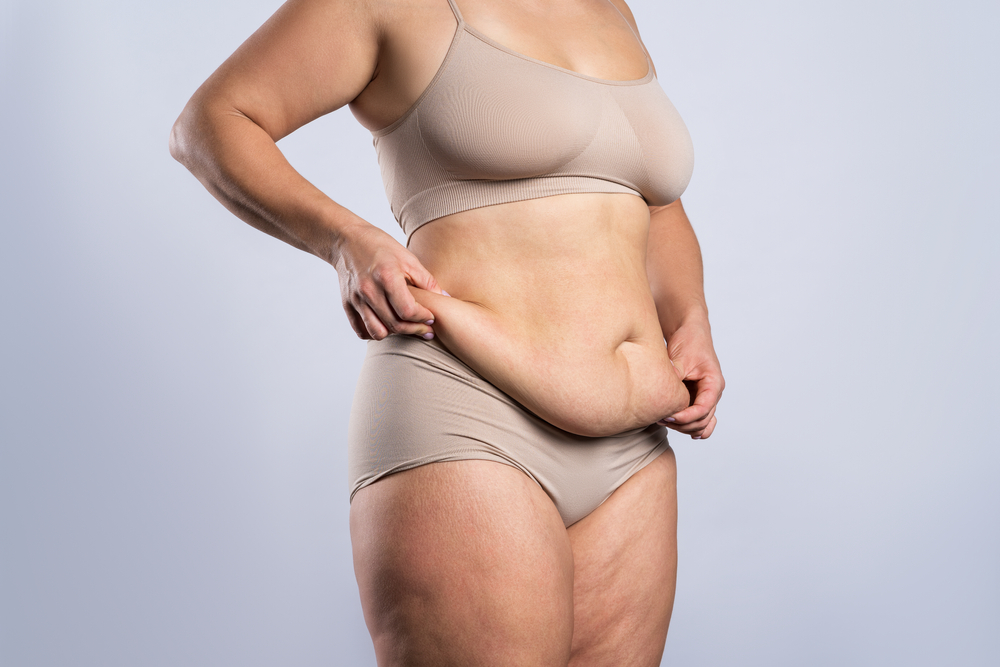 Tummy Tuck and Abdominal Tightening Surgery Appointment Near Abingdon, MD: What to Know Before You Go