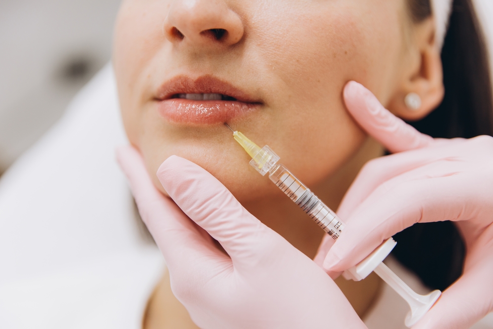 Lip Filler Prices Near Bel Air, MD: Natural Results and Cost