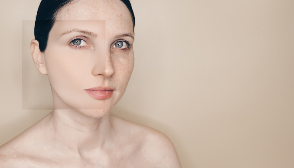 CO₂ and Fractional Laser Resurfacing in Timonium: Benefits, Downtime, and Pricing